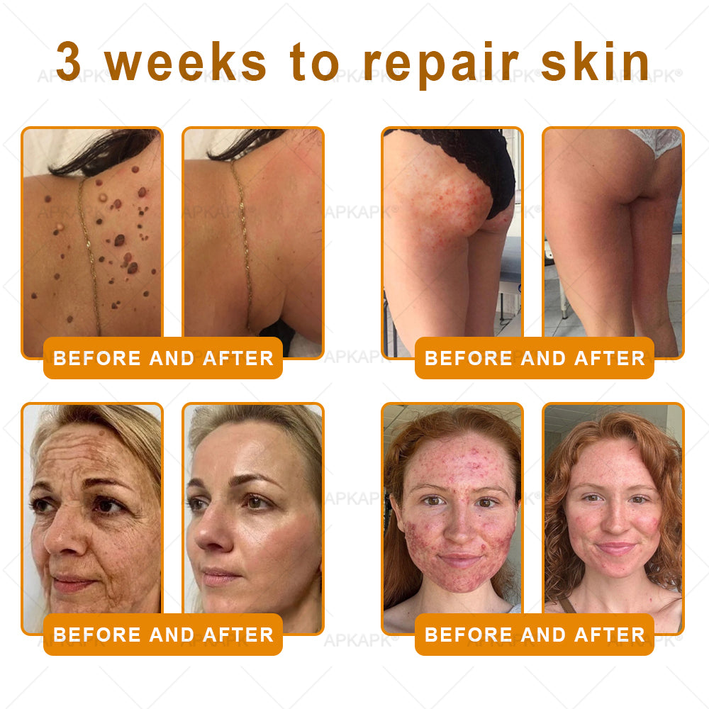 𝖠𝖯𝖪𝖠𝖯𝖪® has a surprise upgrade just for you! You've already got an amazing offer but now you've unlocked an even better one:You'll get a massive 50% off your next purchase - for the next two minutes only!