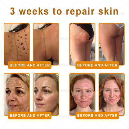 𝖠𝖯𝖪𝖠𝖯𝖪® has a surprise upgrade just for you! You've already got an amazing offer but now you've unlocked an even better one:You'll get a massive 50% off your next purchase - for the next two minutes only!