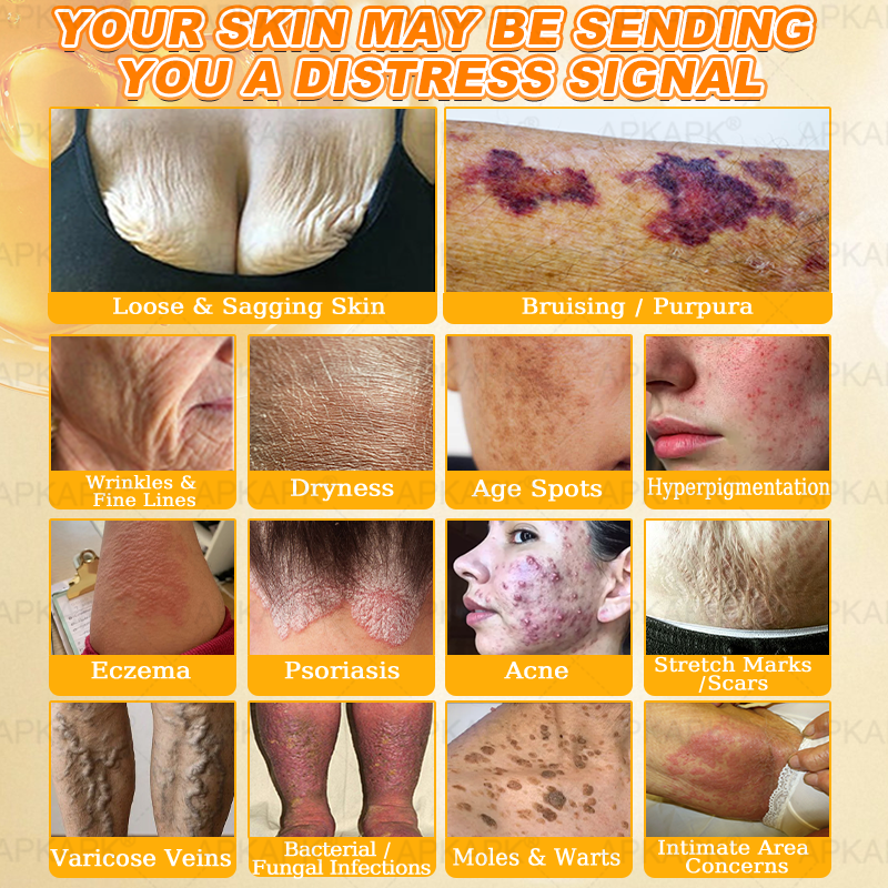 Made and Shipped from USA ✨𝖠𝖯𝖪𝖠𝖯𝖪® 𝖡𝖾𝖾 𝗏𝖾𝗇𝗈𝗆 𝖲𝗄𝗂𝗇 𝖱𝖾𝗌𝗍𝗈𝗋𝖺𝗍𝗂𝗈𝗇 𝖢𝗋𝖾𝖺𝗆 ✨