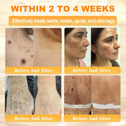 Made and Shipped from USA ✨𝖠𝖯𝖪𝖠𝖯𝖪® 𝖡𝖾𝖾 𝗏𝖾𝗇𝗈𝗆 𝖲𝗄𝗂𝗇 𝖱𝖾𝗌𝗍𝗈𝗋𝖺𝗍𝗂𝗈𝗇 𝖢𝗋𝖾𝖺𝗆 ✨