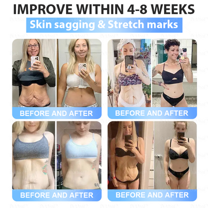 FDA Store🏥| 𝐵uil𝗱𝐿ea𝐟® 𝑺𝑀𝗚T-𝑮𝐋𝑃-1 𝐒limming & 𝐻ealth 𝑁ano 𝑀icroneedle 𝑃atch with Collagen & Matrixyl 3000 丨Obesity,Cardiovascular Diseas, Diabetes, Sleep Apnea, Joint Problems and More