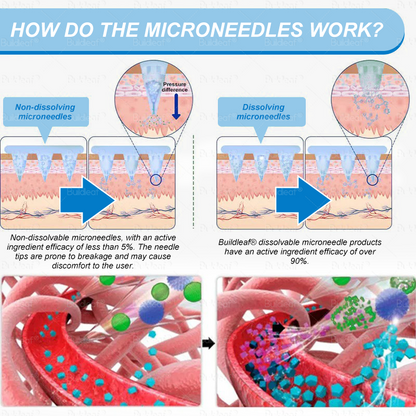 FDA Store🏥| 𝐵uil𝗱𝐿ea𝐟® 𝑺𝑀𝗚T-𝑮𝐋𝑃-1 𝐒limming & 𝐻ealth 𝑁ano 𝑀icroneedle 𝑃atch with Collagen & Matrixyl 3000 丨Obesity,Cardiovascular Diseas, Diabetes, Sleep Apnea, Joint Problems and More