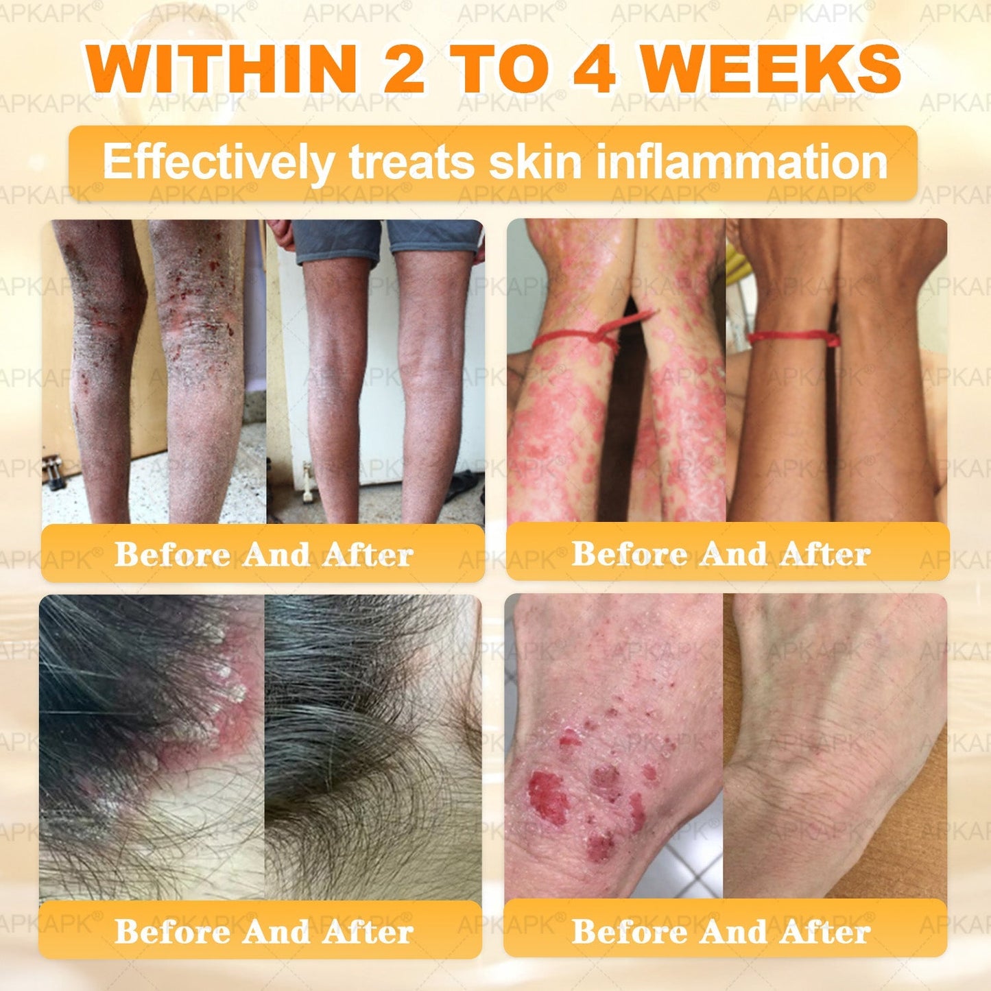 Made and Shipped from USA ✨𝖠𝖯𝖪𝖠𝖯𝖪® 𝖡𝖾𝖾 𝗏𝖾𝗇𝗈𝗆 𝖲𝗄𝗂𝗇 𝖱𝖾𝗌𝗍𝗈𝗋𝖺𝗍𝗂𝗈𝗇 𝖢𝗋𝖾𝖺𝗆 ✨