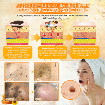 Made and Shipped from USA ✨𝖠𝖯𝖪𝖠𝖯𝖪® 𝖡𝖾𝖾 𝗏𝖾𝗇𝗈𝗆 𝖲𝗄𝗂𝗇 𝖱𝖾𝗌𝗍𝗈𝗋𝖺𝗍𝗂𝗈𝗇 𝖢𝗋𝖾𝖺𝗆 ✨