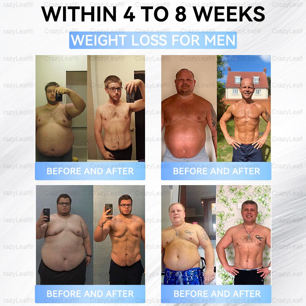 FDA Store🏥| 𝐵uil𝗱𝐿ea𝐟® 𝑺𝑀𝗚T-𝑮𝐋𝑃-1 𝐒limming & 𝐻ealth 𝑁ano 𝑀icroneedle 𝑃atch with Collagen & Matrixyl 3000 丨Obesity,Cardiovascular Diseas, Diabetes, Sleep Apnea, Joint Problems and More