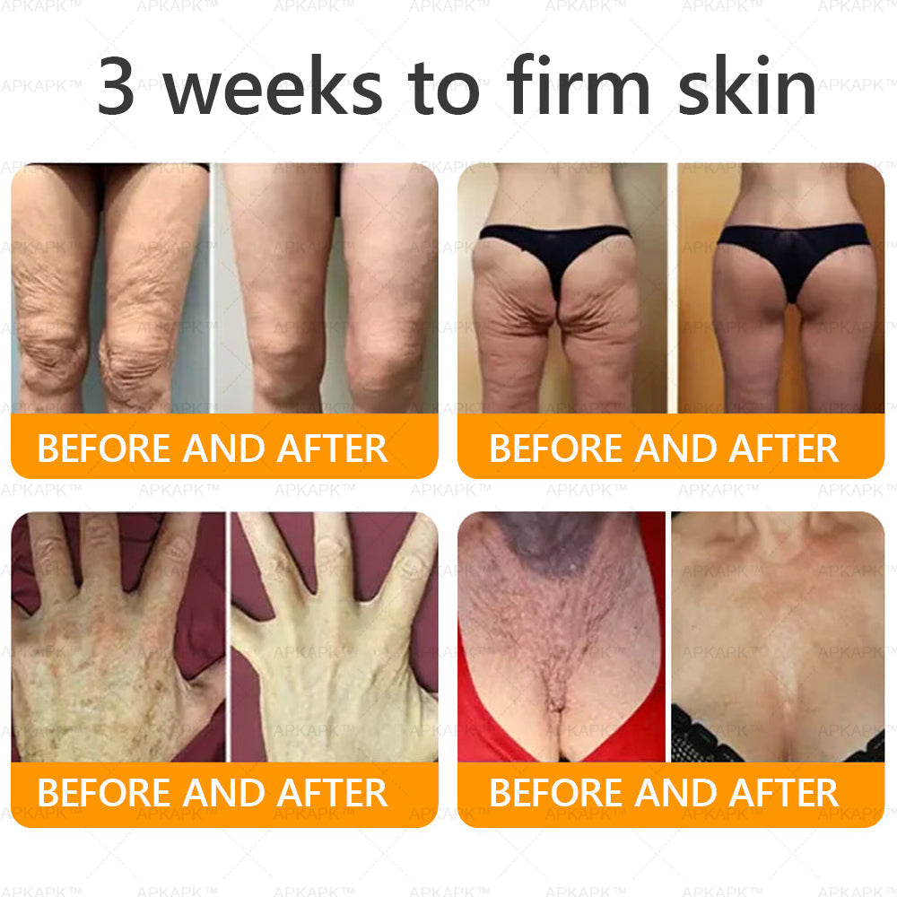 𝖠𝖯𝖪𝖠𝖯𝖪® has a surprise upgrade just for you! You've already got an amazing offer but now you've unlocked an even better one:You'll get a massive 50% off your next purchase - for the next two minutes only!